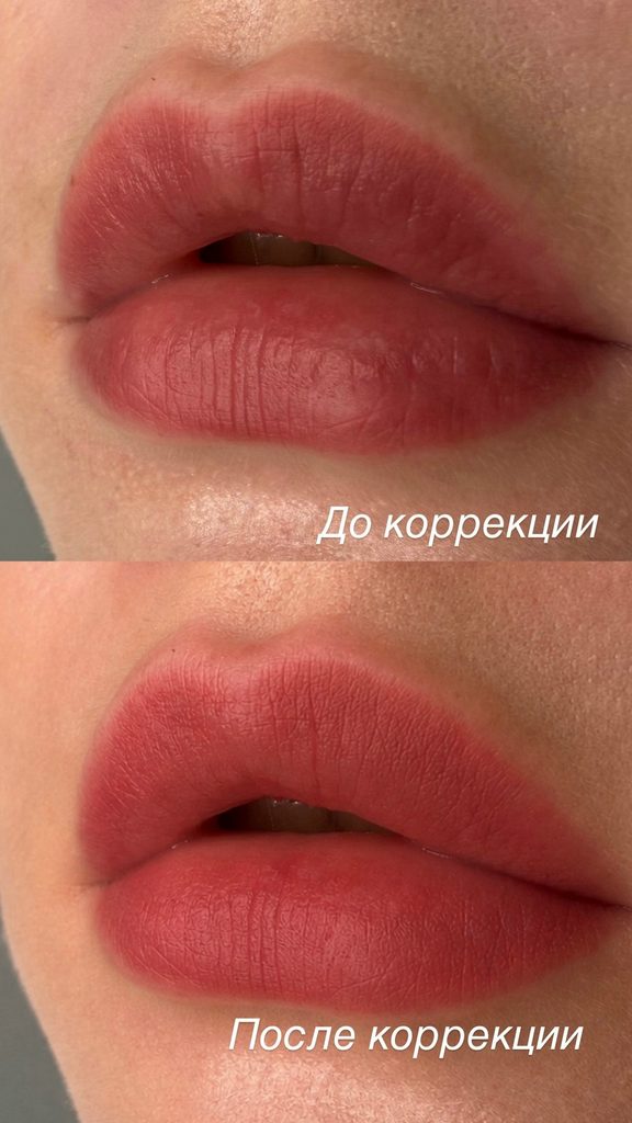 Обновление перманента губ через 1,5–2 года